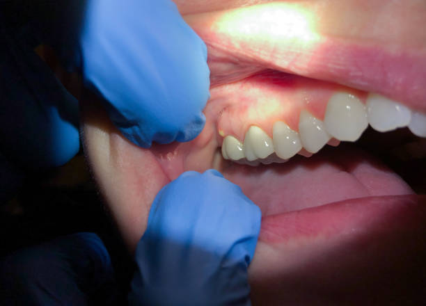 Best Emergency Gum Pain Relief  in La Quinta, CA